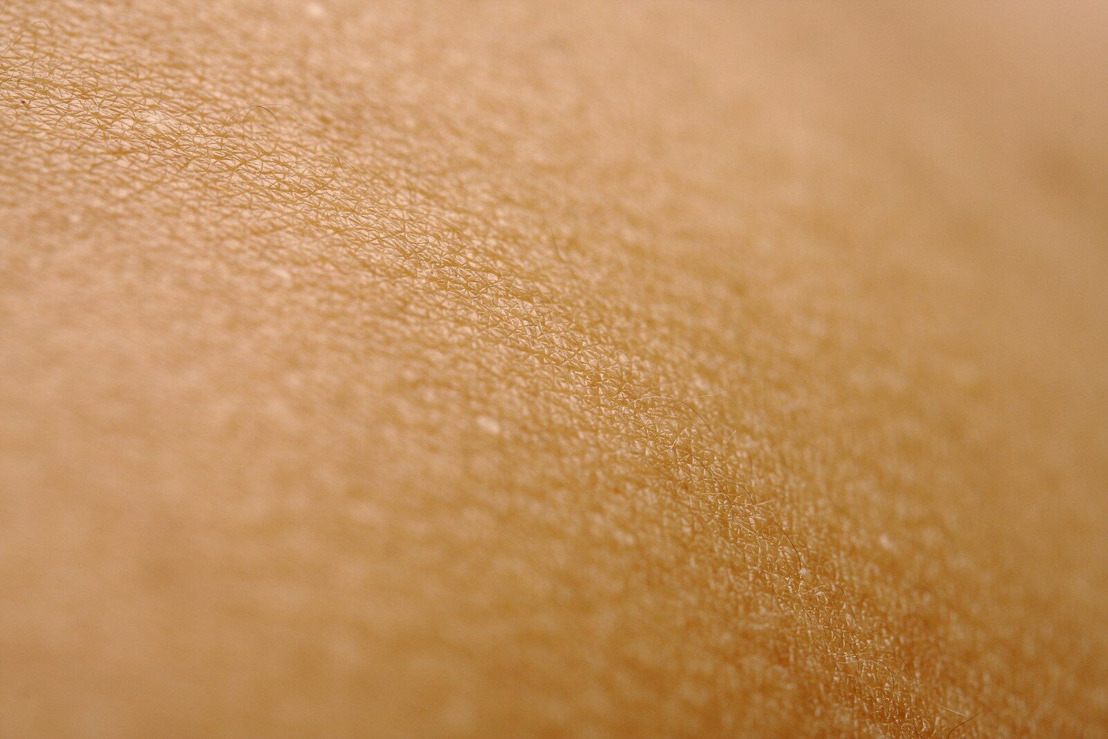 Transepidermal water loss and dry skin barrier clinical skincare